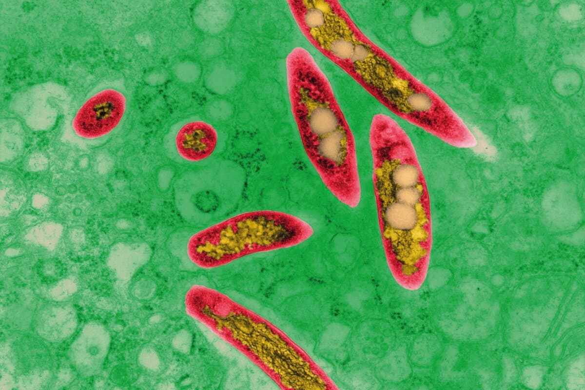 Transmissionselektronenmikroskopische Aufnahme (TEM) des Mycobacterium-avium-Komplexes (MAC) in der menschlichen Lunge. Nichttuberkulöse Mykobakterien verursachen insbesondere bei immunsupprimierten Personen chronische pulmonale Infektionen mit Symptomen ähnlich einer Tuberkulose.