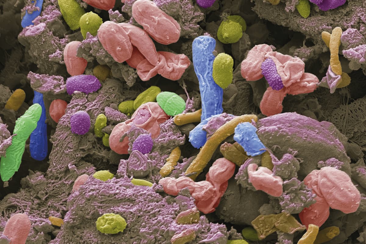 Darmmikrobiom: Rasterelektronenmikroskopische Aufnahme (REM) verschiedener Bakterien aus einer Probe des menschlichen Dünndarms.