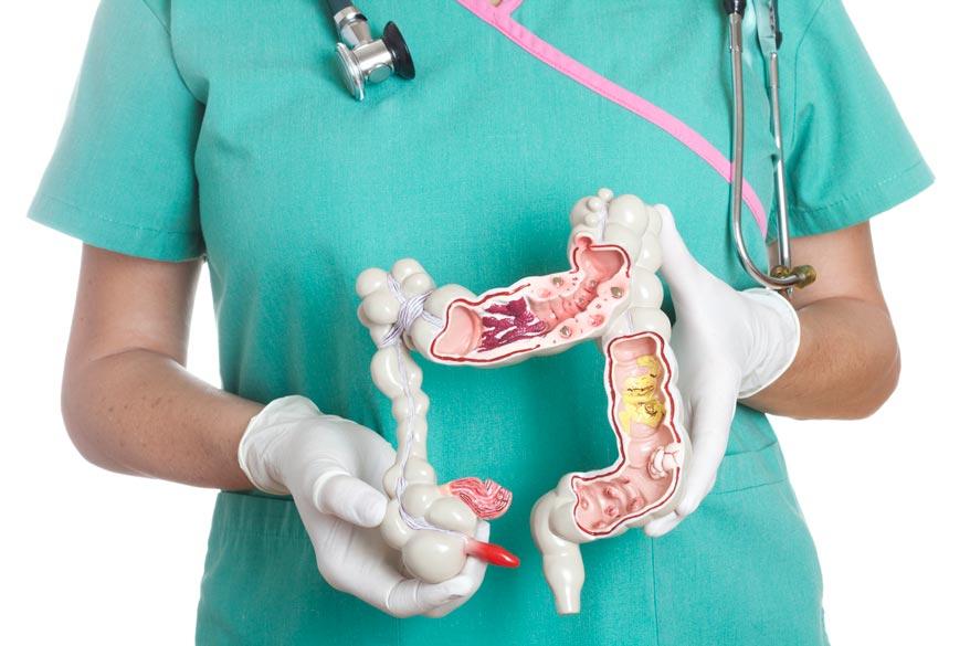 Ärztin hält Anatomisches Modell vom Darm in den Händen