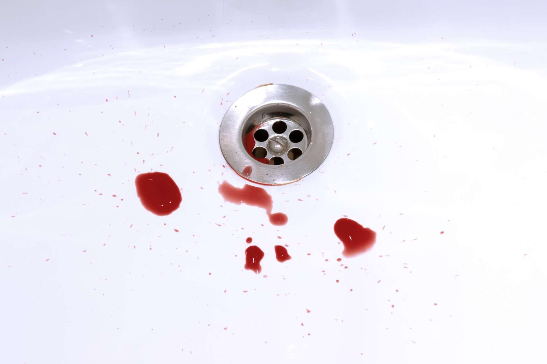 Blutflecken im Waschbecken, Blutungs-, Kriminal- und Selbstmordkonzept.