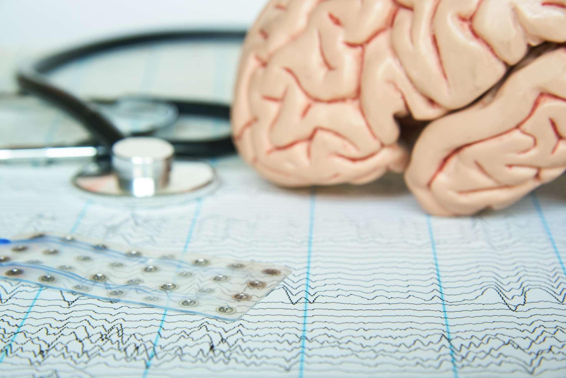 Subdurales Elektrodengitter auf Elektroenzephalographiepapier. Menschliches Gehirnmodell und ein schwarzes Stethoskop auf Hintergrund.