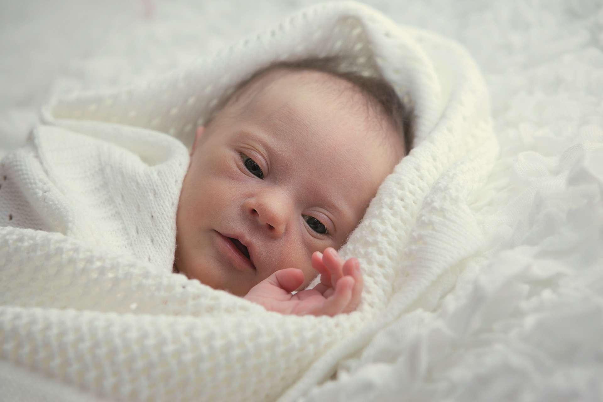 Neugeborene mit Down-Syndrom sind ruhig und sehen aus