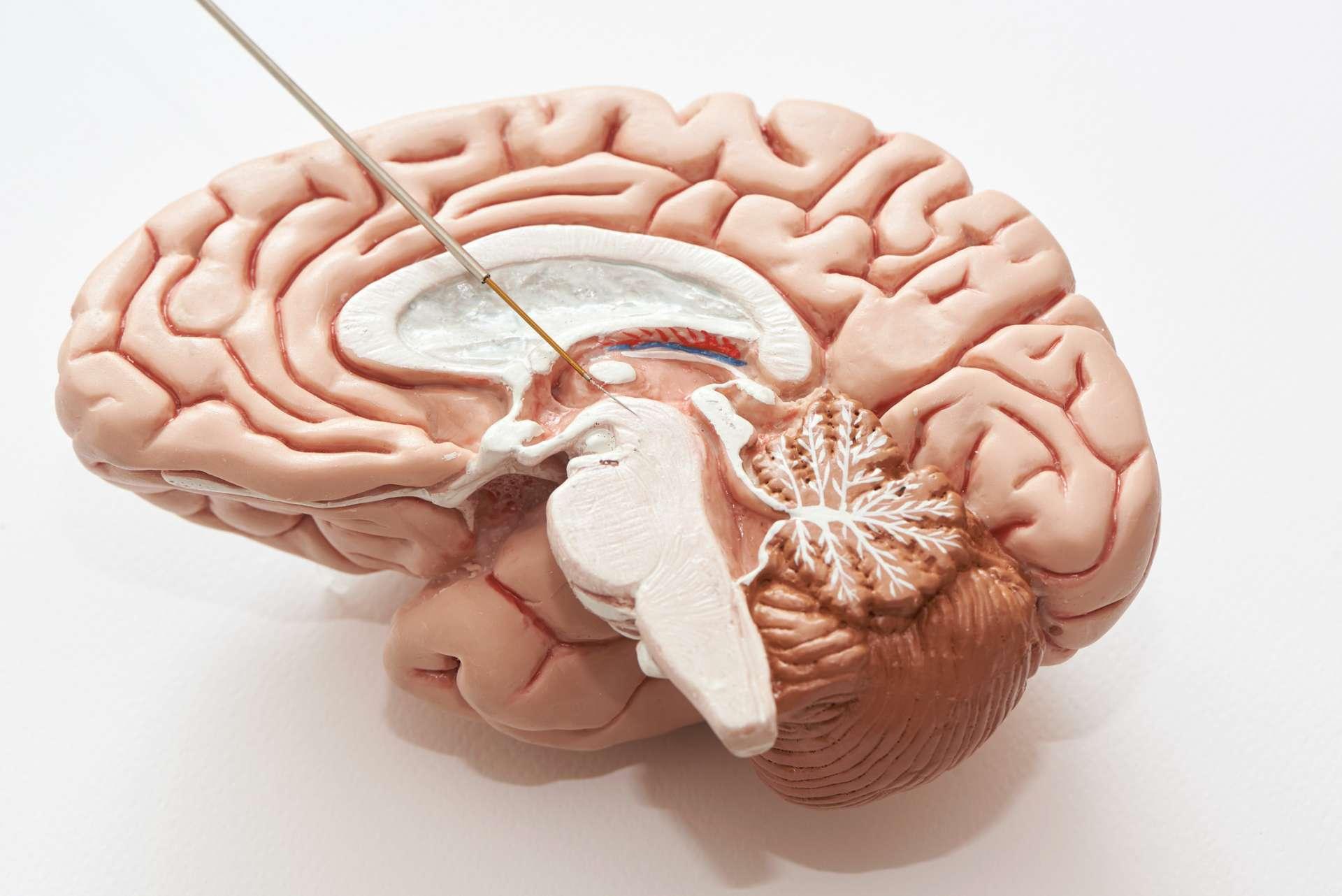 Konzept der Gehirnaufzeichnung im Nucleus subthalamicus für Parkinson