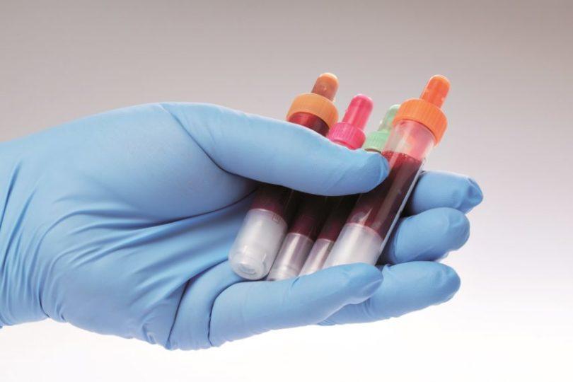 Blutproben befinden sich auf einem Laborformular zur Ermittlung der Blutwerte