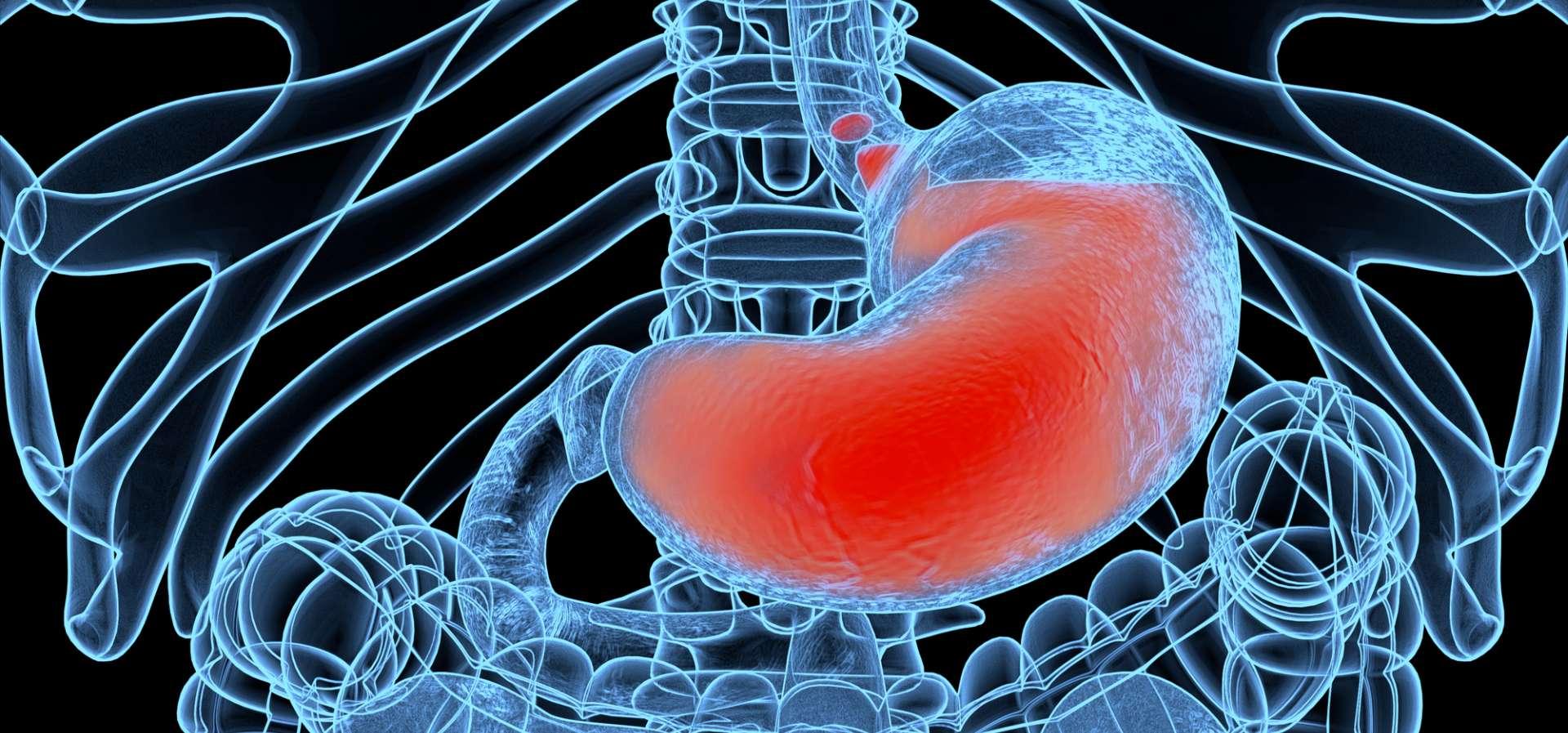 Saurer Rückfluss, GERD. Gastroösophageale Refluxkrankheit. Magen und Verdauung. Menschliche Anatomie. 3D-Illustration
