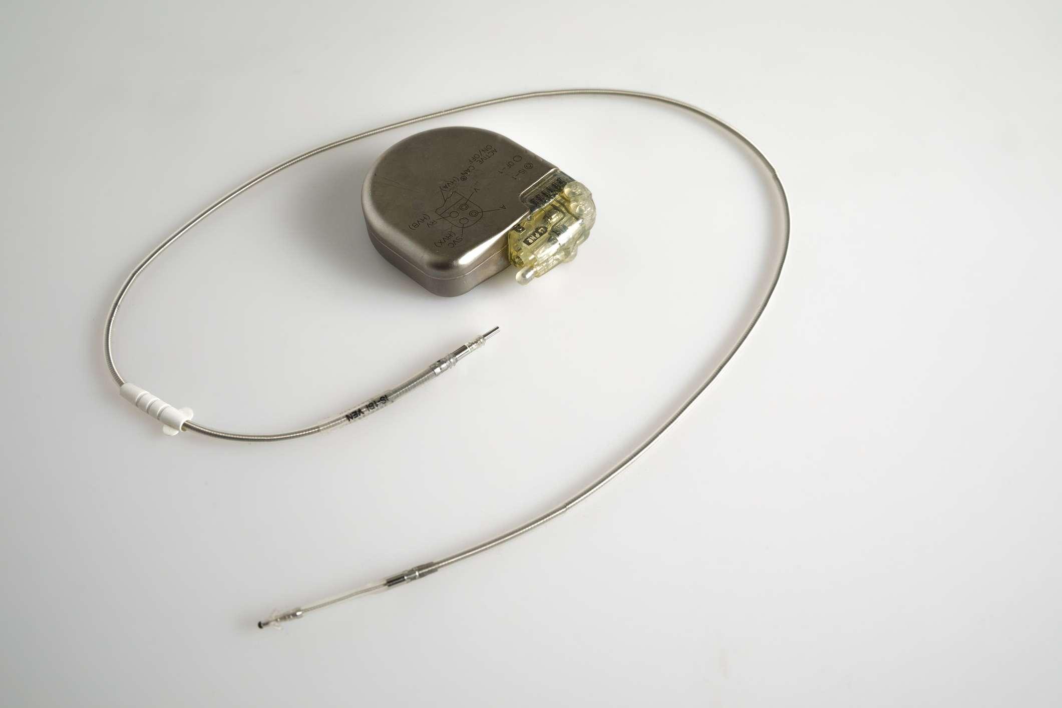 Ein implantierbarer Kardioverter-Defibrillator oder ein ICD-Schrittmacher mit Elektroden. Dieser wird in der Brust platziert, um einen plötzlichen Tod zu verhindern, wenn Patienten eine ventrikuläre Tachykardie oder Kammerflimmern erlitten haben