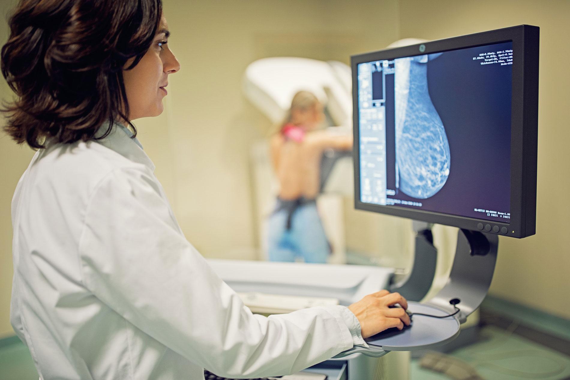 Un médecin regarde des images de mammographie