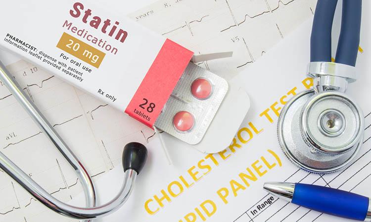 Offene Verpackung mit Medikamententabletten, auf der &#8222;Statin Medication&#8220; steht, liegt in der Nähe von Stethoskop, Ergebnisanalyse zu Cholesterin (Lipidpanel) und EKG