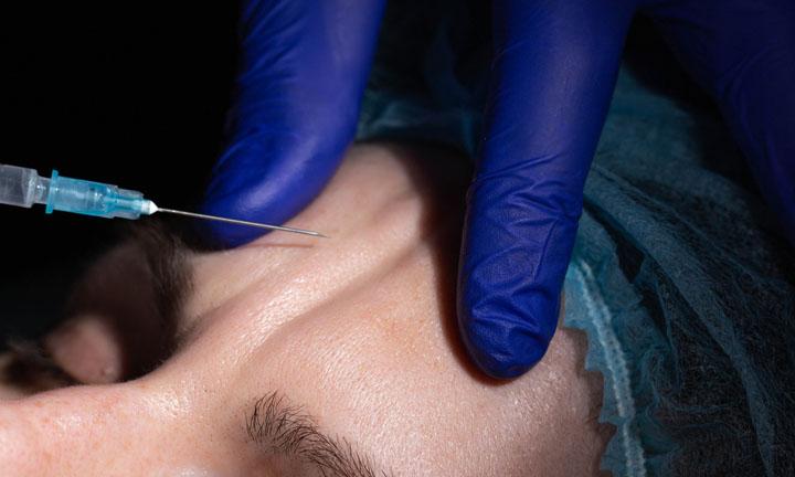 Doctor cosmetologist makes botulinum therapy injections to smooth forehead wrinkles.