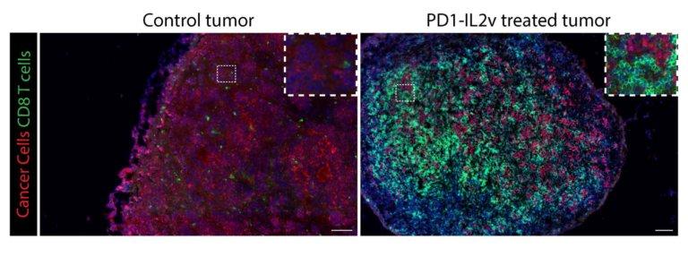 CD8-positive T-Zellen in Tumoren behandelt mit anti-PD-L1/PD1-IL2v