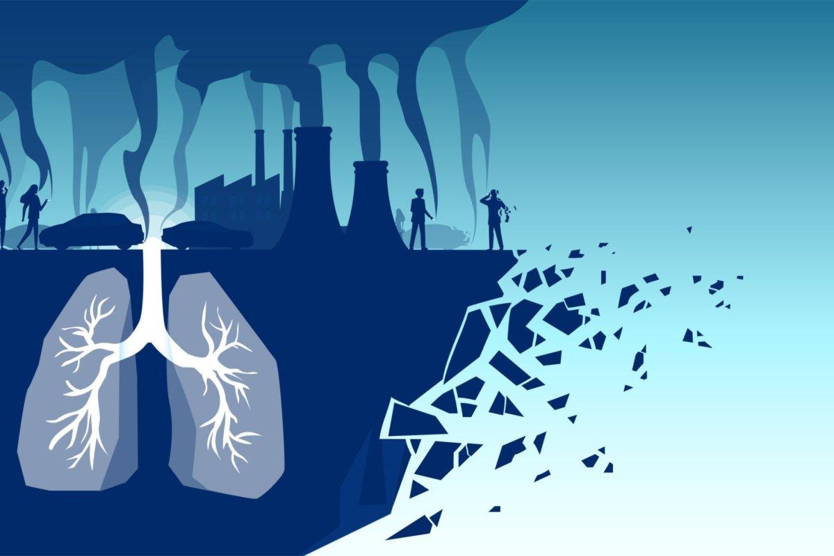 Erhöhte Feinstaubbelastungen gefährden die Lungenfunktion von ILD-Patienten.