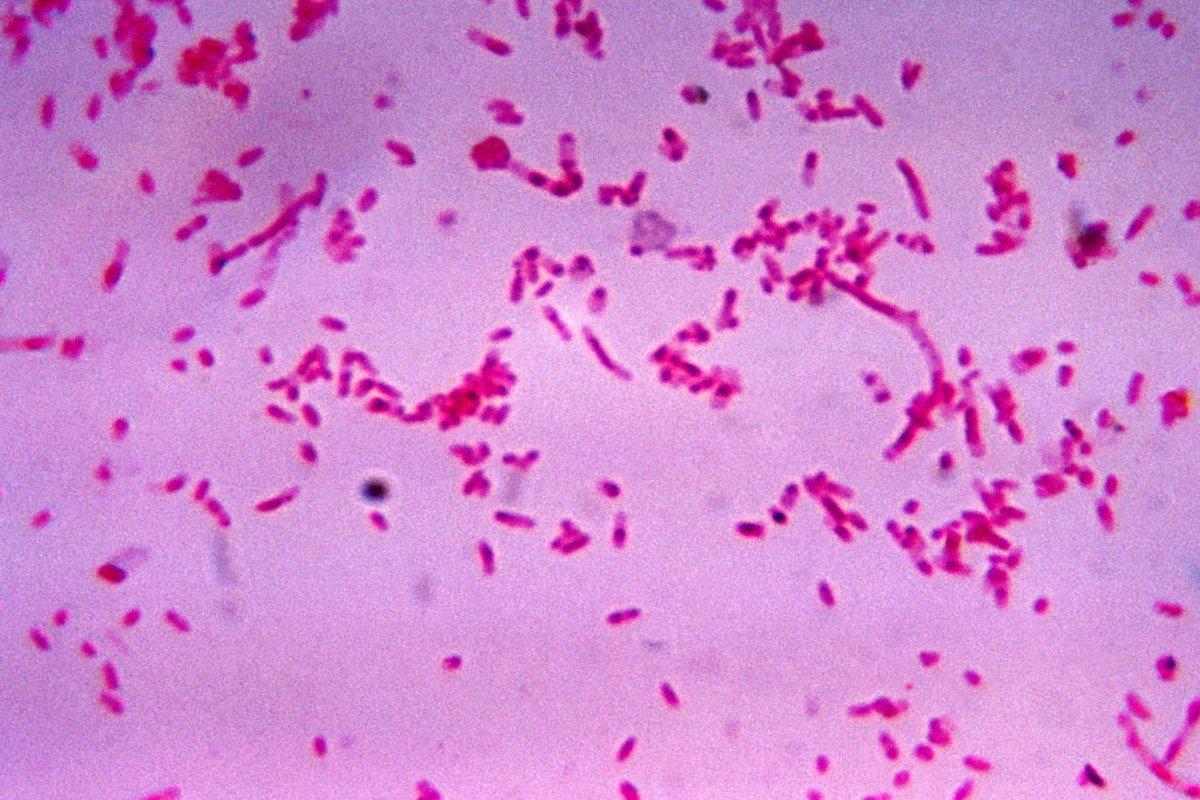 Fusobakterien könnten in die Entstehung der Endometriose involviert sein.