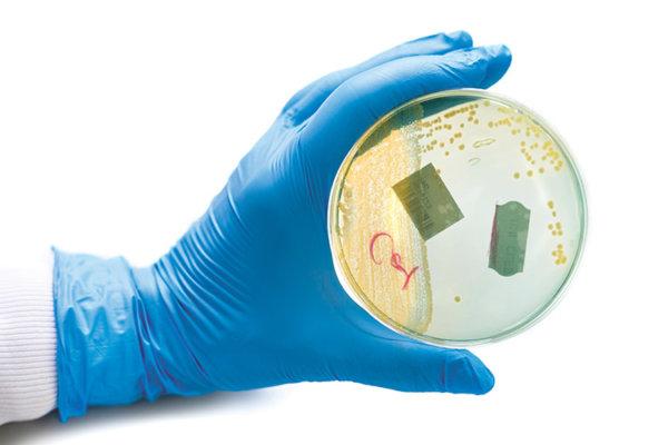 Hand mit medizinischem Handschuh hält eine Petrischale mit colifoformen Bakterien.
