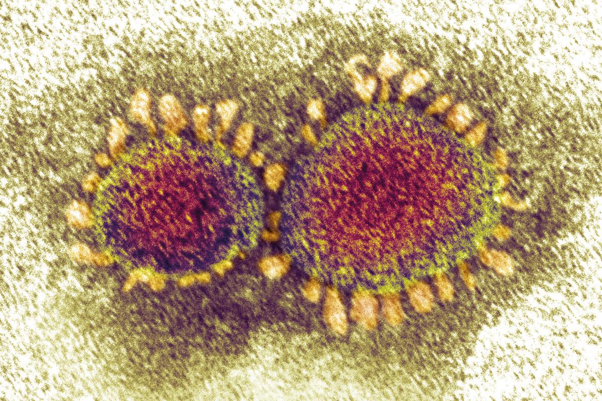 Mikroskopische Aufnahme des Covid-19 Coronavirus