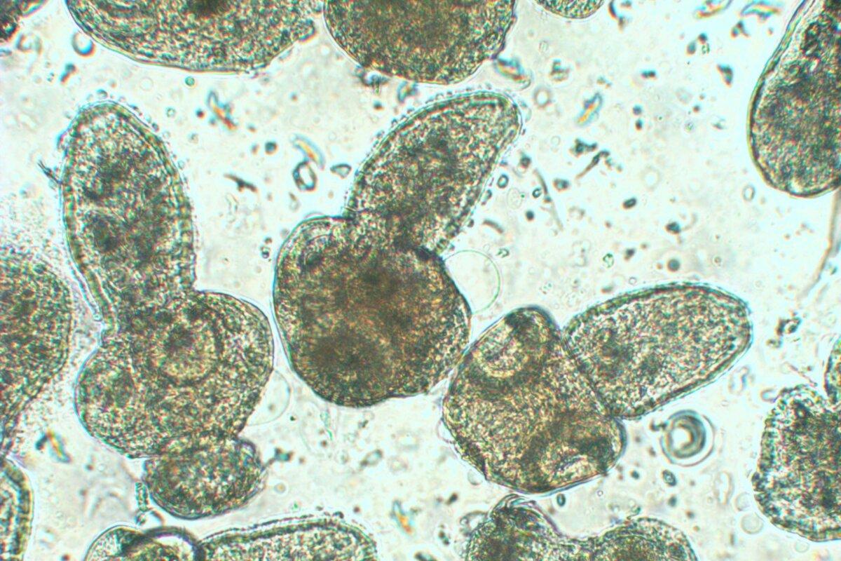 Mikroskopischer Nachweis einer Echinokokkose.