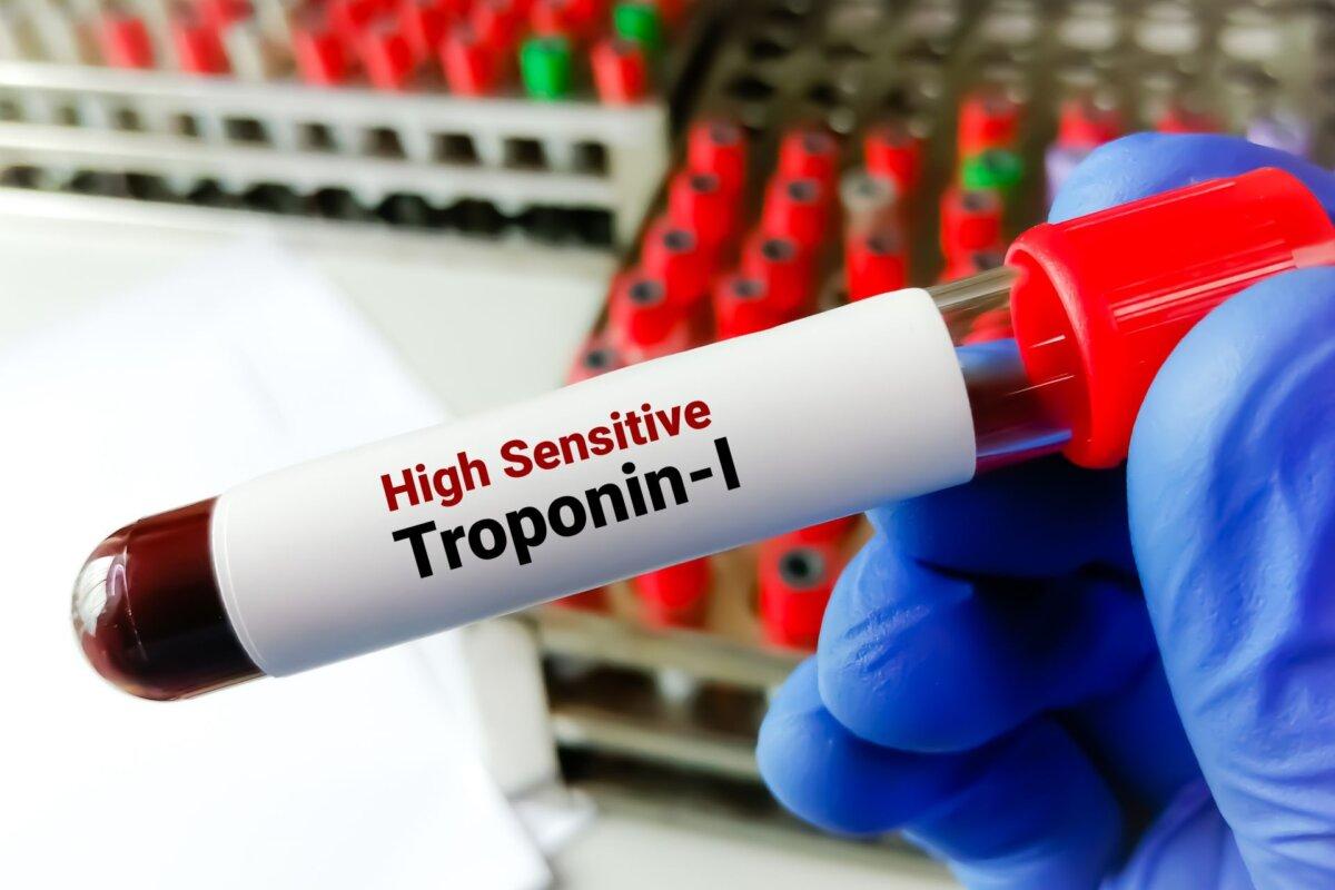 Tests auf hochsensitives Troponin-I nutzen vor allem Patienten mit nichtischämischen Myokardläsionen.